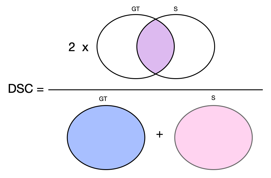A visual formula illustrating the Dice similarity coefficient