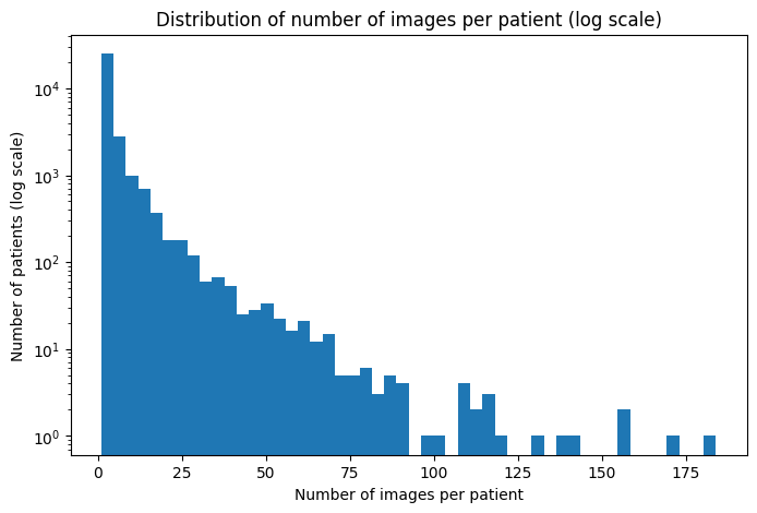 Bar chart showing the distribution of the number of images per patient in the NIH Chest X-ray dataset, highlighting that the majority of patients have very few images while a small subset has a high frequency of repeat scans.